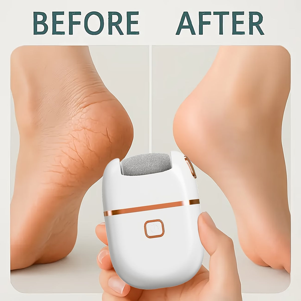 Electric Feet Callus Remover